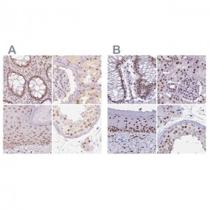 Anti-PPP1R10 antibody produced in rabbit 