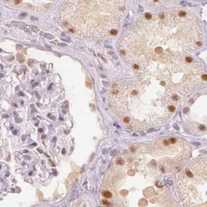 Anti-PPP1R10 antibody produced in rabbit 
