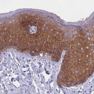 Anti-PPP1R13L antibody produced in rabbit 