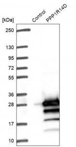 Anti-PPP1R14D antibody produced in rabbit 
