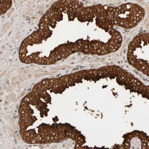 Anti-PPP1R16A antibody produced in rabbit 