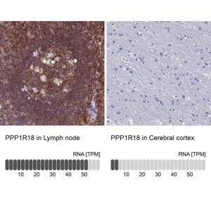 Anti-PPP1R18 antibody produced in rabbit 