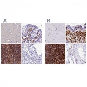 Anti-PPP1R18 antibody produced in rabbit 