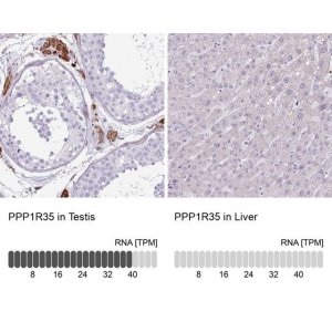Anti-PPP1R35 antibody produced in rabbit 