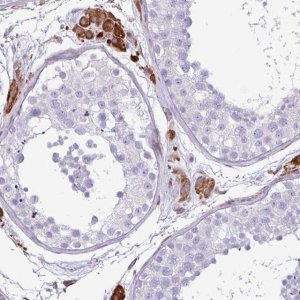 Anti-PPP1R35 antibody produced in rabbit 