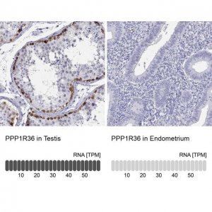 Anti-PPP1R36 