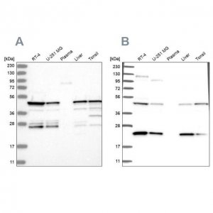 Anti-PPP1R7 antibody produced in rabbit 