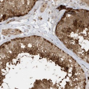 Anti-PPP1R7 antibody produced in rabbit 