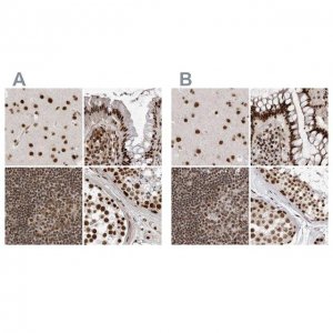 Anti-PPP1R8 antibody produced in rabbit 