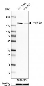 Anti-PPP2R3A antibody produced in rabbit 