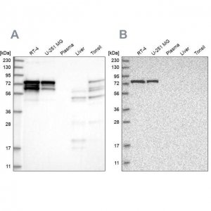 Anti-PPP2R5D antibody produced in rabbit 