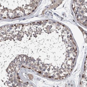 Anti-PPP2R5D antibody produced in rabbit 