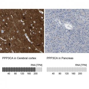 Anti-PPP3CA antibody produced in rabbit HPA012778-100UL