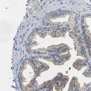 Anti-PPP3CA antibody produced in rabbit HPA012778-100UL