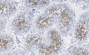 Anti-PPP3CC Antibody, clone 2C2 ZooMAb Rabbit Monoclonal 