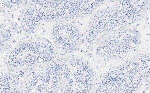 Anti-PPP3CC Antibody, clone 2C2 ZooMAb Rabbit Monoclonal 