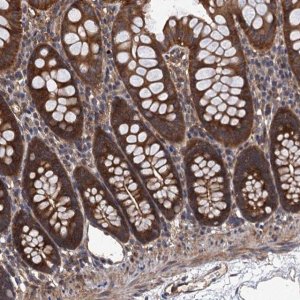 Anti-PPP4R1 antibody produced in rabbit 