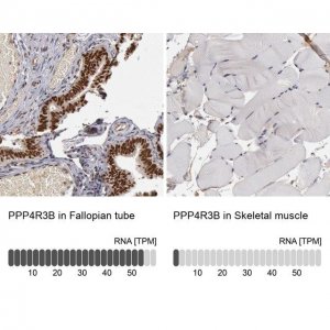 Anti-PPP4R3B antibody produced in rabbit HPA001233-100UL