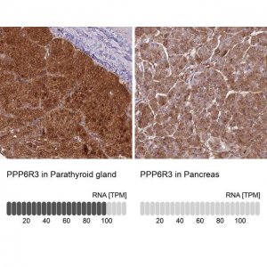 Anti-PPP6R3 antibody produced in rabbit 