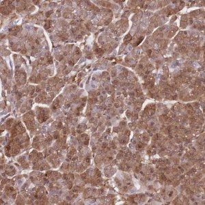 Anti-PPP6R3 antibody produced in rabbit 