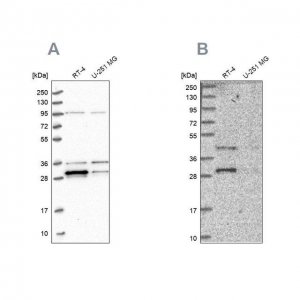 Anti-PPTC7 antibody produced in rabbit 