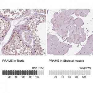 Anti-PRAME antibody produced in rabbit 