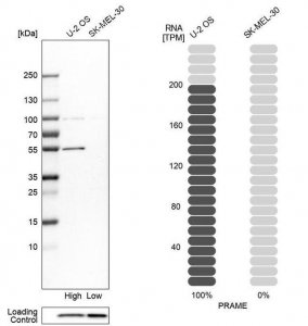 Anti-PRAME antibody produced in rabbit 