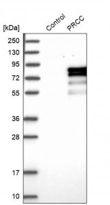 Anti-PRCC antibody produced in rabbit 