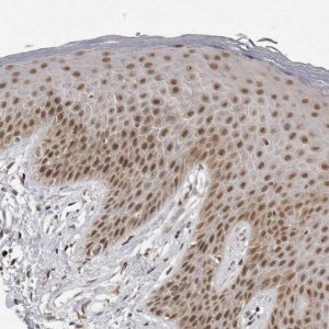 Anti-PRDM10 antibody produced in rabbit HPA026997-100UL