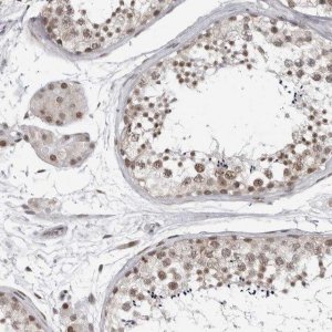 Anti-PRDM10 antibody produced in rabbit HPA026997-100UL
