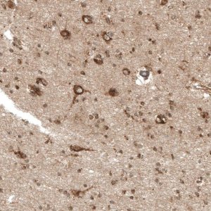 Anti-PREX1 antibody produced in rabbit 