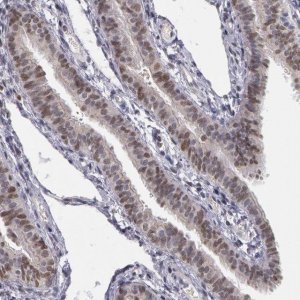 Anti-PRICKLE1 antibody produced in rabbit 