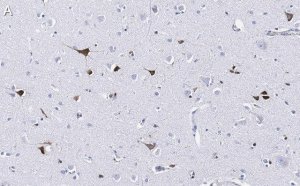 Anti-Prion Protein Antibody, clone 3F17 ZooMAb Rabbit Monoclonal 