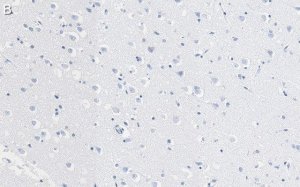 Anti-Prion Protein Antibody, clone 3F17 ZooMAb Rabbit Monoclonal 