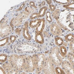 Anti-PRKAB1 antibody produced in rabbit 