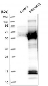 Anti-PRKAR1B antibody produced in rabbit 