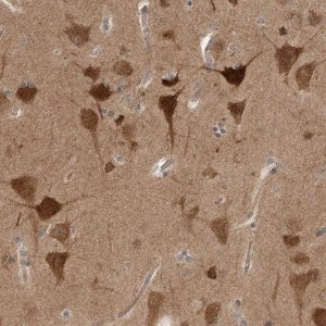 Anti-PRKAR1B antibody produced in rabbit 