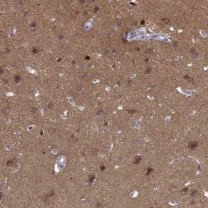 Anti-PRKCE antibody produced in rabbit 