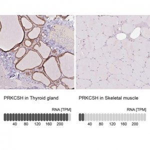 Anti-PRKCSH antibody produced in rabbit 