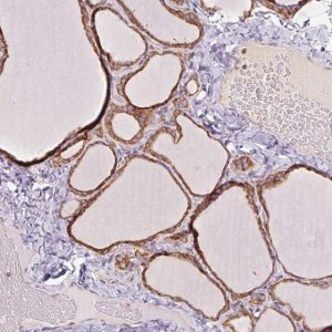 Anti-PRKCSH antibody produced in rabbit 