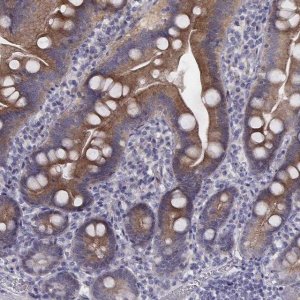 Anti-PRKCZ antibody produced in rabbit 