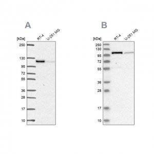 Anti-PRKD2 antibody produced in rabbit 