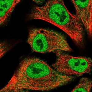 Anti-PRKD2 antibody produced in rabbit 