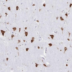 Anti-PRKRA antibody produced in rabbit 