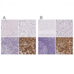 Anti-PRL antibody produced in rabbit 