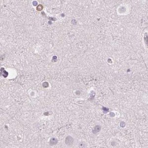 Anti-PRL antibody produced in rabbit 