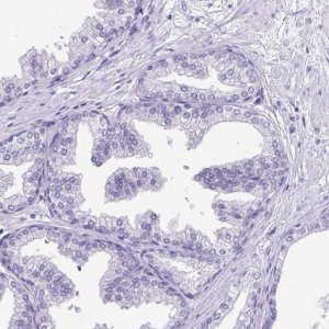 Anti-PRM2 antibody produced in rabbit 