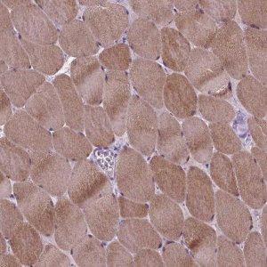 Anti-PROB1 antibody produced in rabbit 