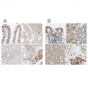 Anti-PROS1 antibody produced in rabbit 