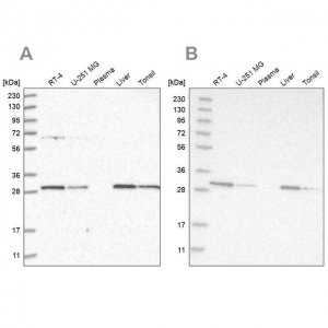 Anti-PROSC antibody produced in rabbit HPA023733-100UL